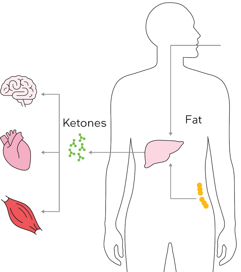 Ketosis