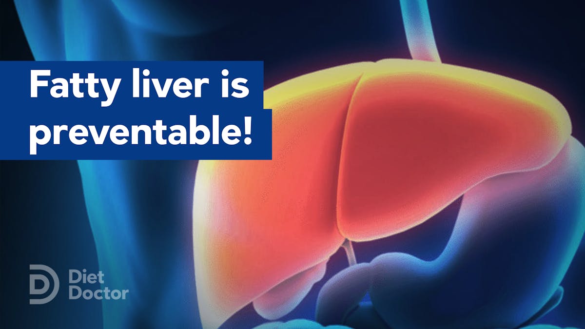 Good and bad news for fatty liver