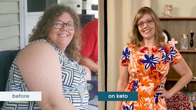 After losing 120 pounds, Erica has tons of energy and no fatty liver
