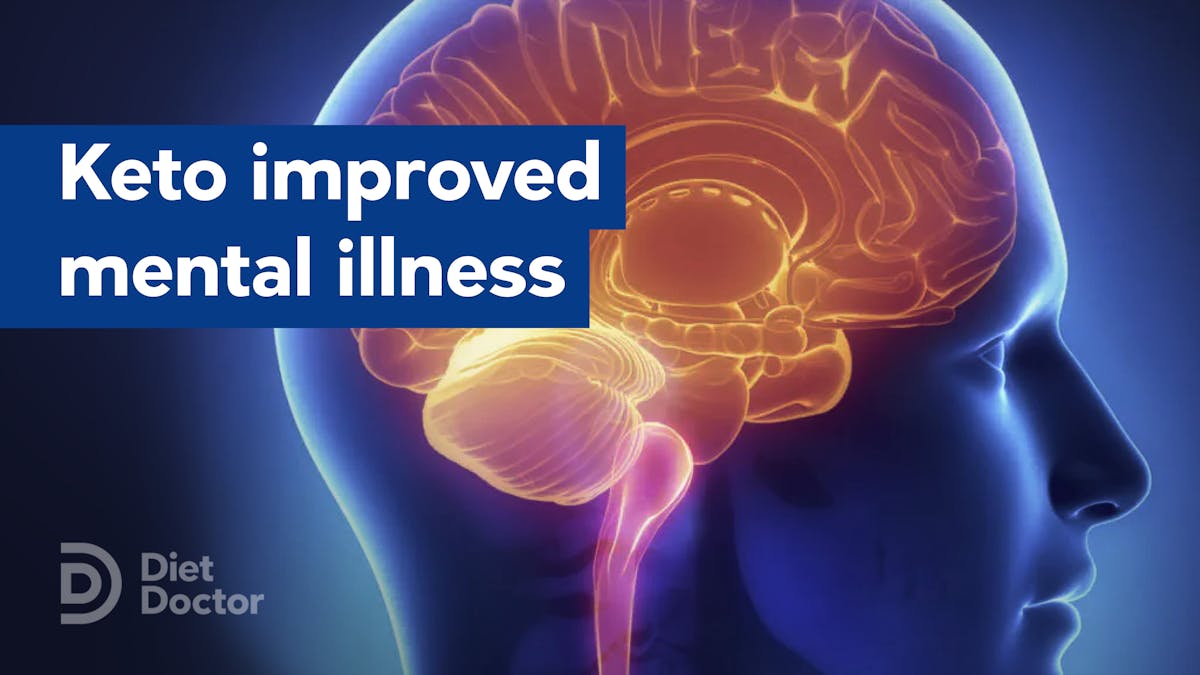 Keto diet improves mental illness
